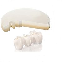 Zirconia dental material UT for dental inlaysfor dental onlaysfor dental veneers