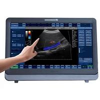 Portable ultrasound system KND-15for multipurpose ultrasound imagingB/Wcolor doppler
