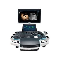 On-platform ultrasound system Resona 7for multipurpose ultrasound imagingfor gynecological and obstetric ultrasound imaging3D/4D
