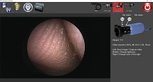 Endoscopy software for controlcapture
