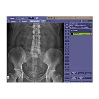 Radiography software CXDI visualizationacquisitiontreatment