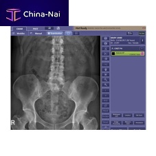 Radiography software CXDI visualizationacquisitiontreatment