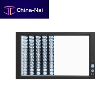 1-screen X-ray film viewer FV-12-screen3-screen4-screen