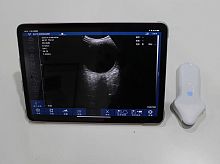 Portable ultrasound system SIFULTRAS-5.04for gynecological and obstetric ultrasound imagingcolor dopplerwireless probe
