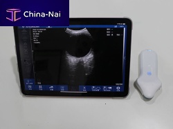 Portable ultrasound system SIFULTRAS-5.04for gynecological and obstetric ultrasound imagingcolor dopplerwireless probe