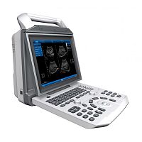 Portable ultrasound system SLE 901for multipurpose ultrasound imagingB/Wbuilt-in console