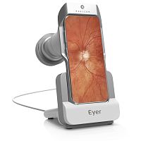 Non-mydriatic retinal camera M-STDhand-held