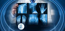 Radiology software Radiologyorthopedicplanningjoint