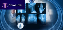 Radiology software Radiologyorthopedicplanningjoint