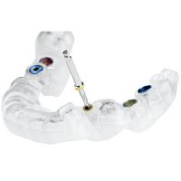 Dental implantology surgical guide