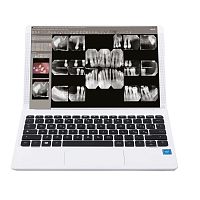 Dental software iRYSmanagementviewerfor control