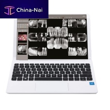 Dental software iRYSmanagementviewerfor control