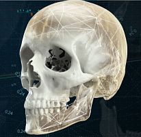 3D viewing software CMFmedicalhospitalclinical