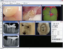 Dental imaging software DBSWIN visualizationdiagnosticdesign