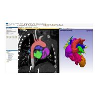 Medical imaging software Simplewaremedicalpoint-of-carediagnostic