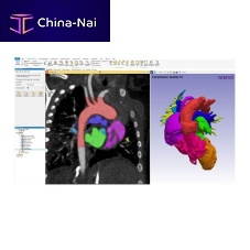 Medical imaging software Simplewaremedicalpoint-of-carediagnostic