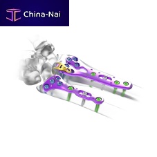 Wrist compression plate 26.24 seriesdistallockingtitanium