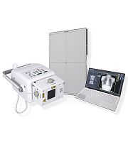 Portable radiography system HomeRaydigitalfor multipurpose radiographywithout table