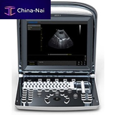 Portable ultrasound system Eco 3for gynecological and obstetric ultrasound imagingB/Wbuilt-in console