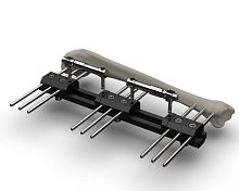 Humerus external fixation system TF-ERStubularadult