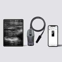 Portable veterinary ultrasound system BL Tecnoscanmultipurposewireless probe