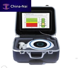 Ultrasound bone densitometer Echoscone beam