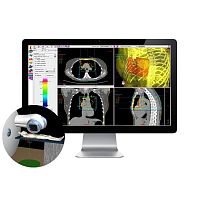 Radiation therapy software SIMAgosimulation