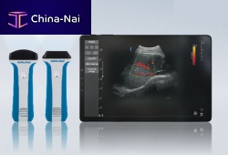 Hand-held ultrasound system uREzpocusfor multipurpose ultrasound imagingB/Wcolor doppler