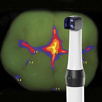 Laser fluorescence caries detector CamX Spectrafluorescencewith dental plaque detection