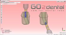 Dental laboratory software GO2dentalCAM