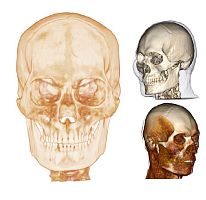 Medical software Medical Design Studioanatomy3D viewingdesign