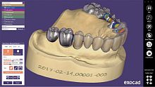 CAD software exocad ®clinicaldentalfor dental imaging
