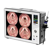 Endoscopy display QVION HD/FHDfull HD4.3"