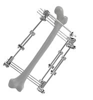 Femur external fixation system 201501tubularadult