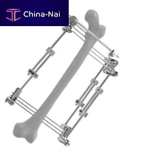 Femur external fixation system 201501tubularadult