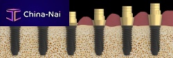 Spiral implant abutment K80 titaniumconicalinternal