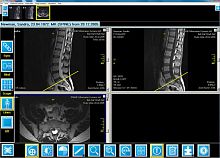 Radiology software iQ-VIEW/PROfor nuclear medicinereportingvisualization