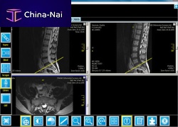 Radiology software iQ-VIEW/PROfor nuclear medicinereportingvisualization