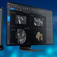 Medical software SmartV-ENTENTmedical imagingfor dental implantology