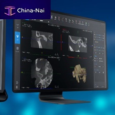 Medical software SmartV-ENTENTmedical imagingfor dental implantology