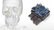 Maxillofacial surgery instrument kit CFx