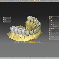 Dental laboratory software inLab for dental implantologyfor dental restorationsdesign