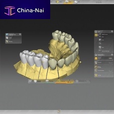 Dental laboratory software inLab for dental implantologyfor dental restorationsdesign