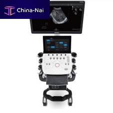On-platform ultrasound system P25 Elitefor gynecological and obstetric ultrasound imagingfor abdominal and pelvic ultrasound imagingfor cardiovascular ultrasound imaging