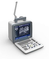 Portable ultrasound system DP-6800 for gynecological and obstetric ultrasound imagingfor abdominal and pelvic ultrasound imagingfor urology ultrasound imaging