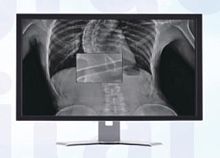 Radiology software MADXVIEWvisualizationfor tablet PC