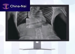 Radiology software MADXVIEWvisualizationfor tablet PC