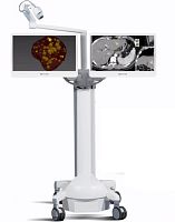 Interventional radiology surgical navigation system CAS-One® IRoptical