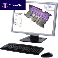 Dental laboratory software Exocad® designCADplanning