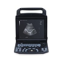 Portable ultrasound system YSB-M5for multipurpose ultrasound imagingB/Wbuilt-in console